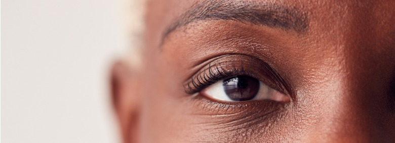 Rugas nos olhos e tratamentos para rejuvenescimento
