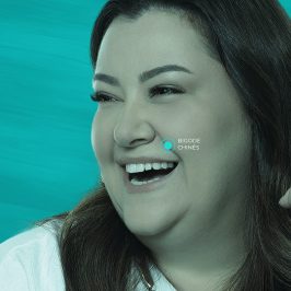 Preenchimento de Bigode Chinês com ácido hialurônico (Restylane 1ml)