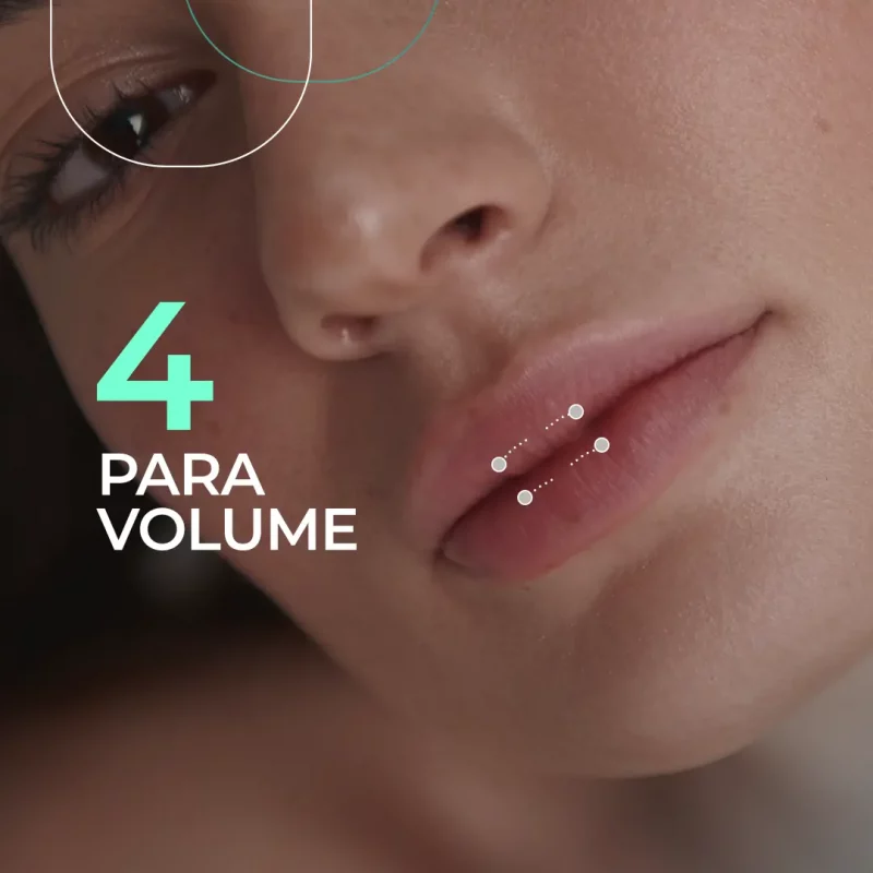 preenchimento labial para volume